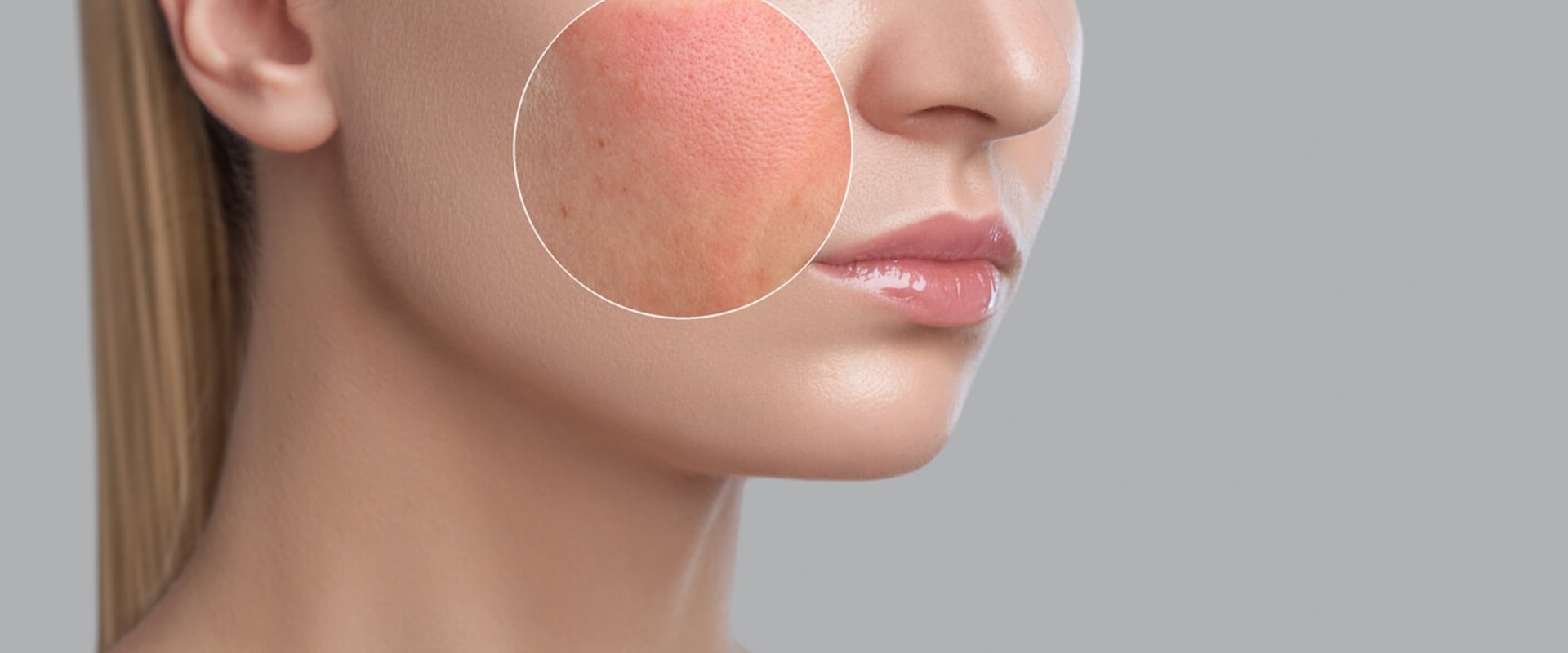 A Guide to Finding the Right Clinic for Skin Conditions and Diseases