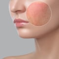 A Guide to Finding the Right Clinic for Skin Conditions and Diseases